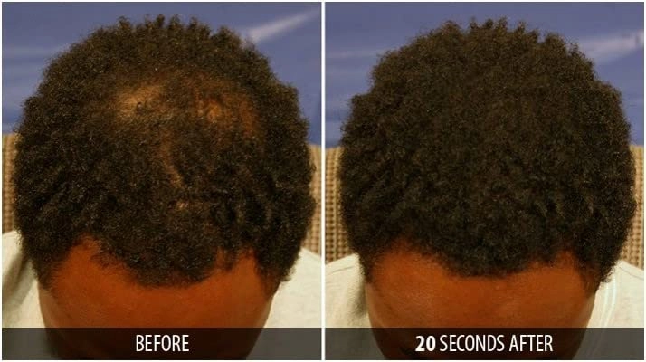 Dr. Yates MD Keratin Fiber Hair Enhancer (Medium Brown)