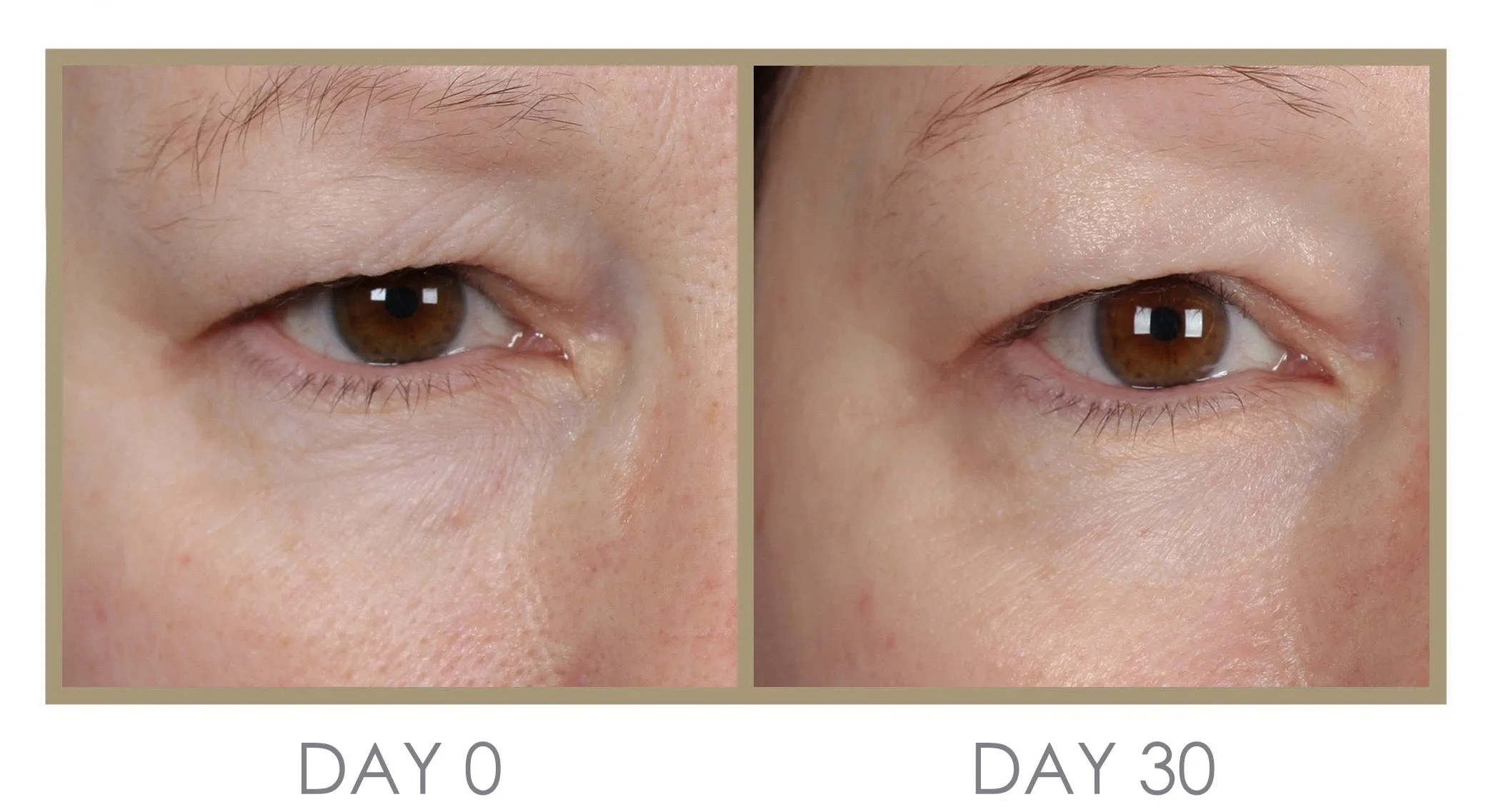 H'eye'drator Eye Cream by Genie Beauty (Ships in 2-3 Weeks)