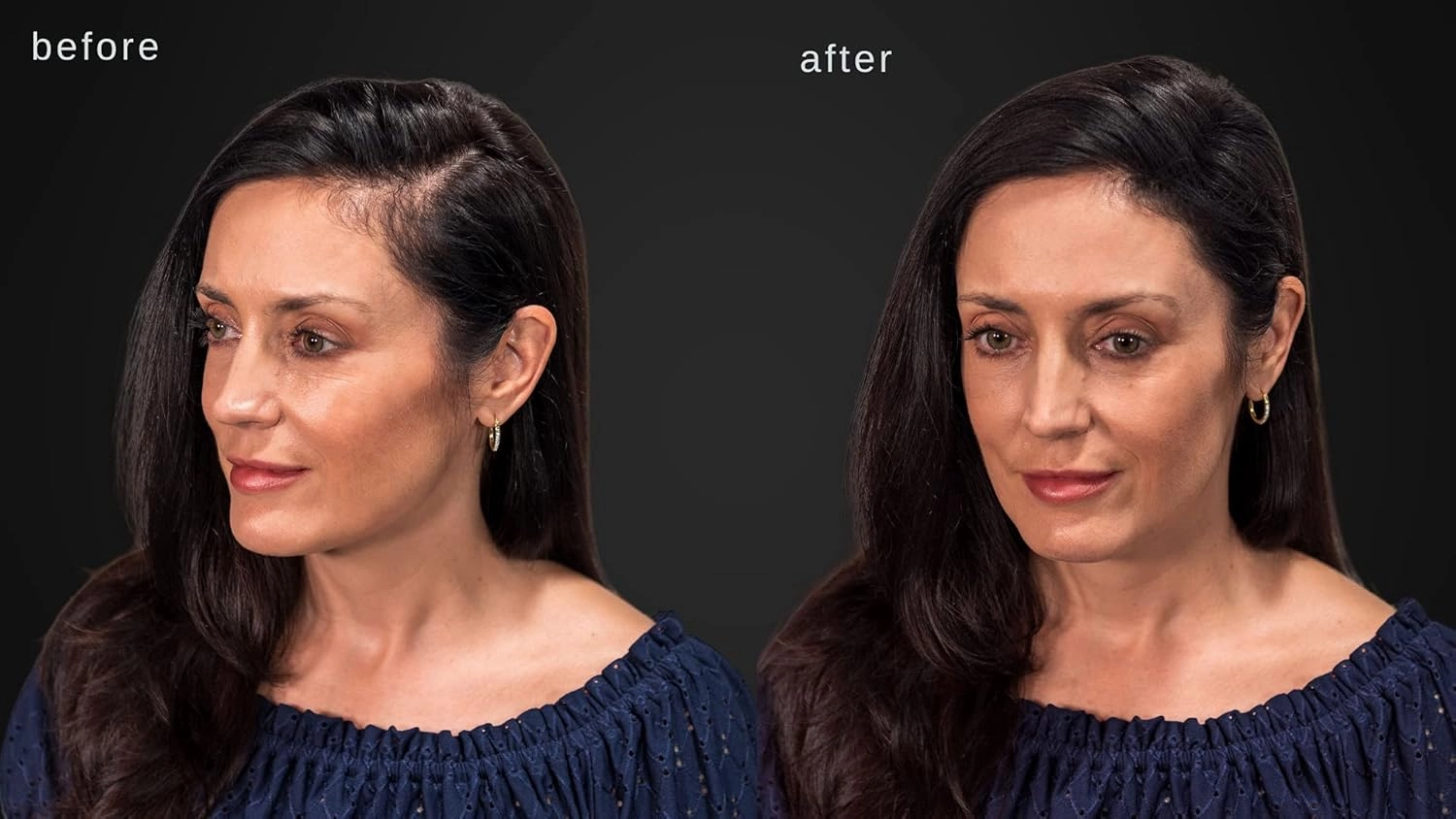 LUXE Hair Thickening Fibers - CONFIDENCE IN A JAR – 2 Months  Supply! – Hypoallergenic, Dermatologist Tested – Multiple Colors Available (Dark Brown)