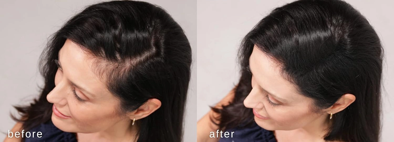 LUXE Hair Thickening Fibers - CONFIDENCE IN A JAR – 2 Months  Supply! – Hypoallergenic, Dermatologist Tested – Multiple Colors Available (Medium Brown)