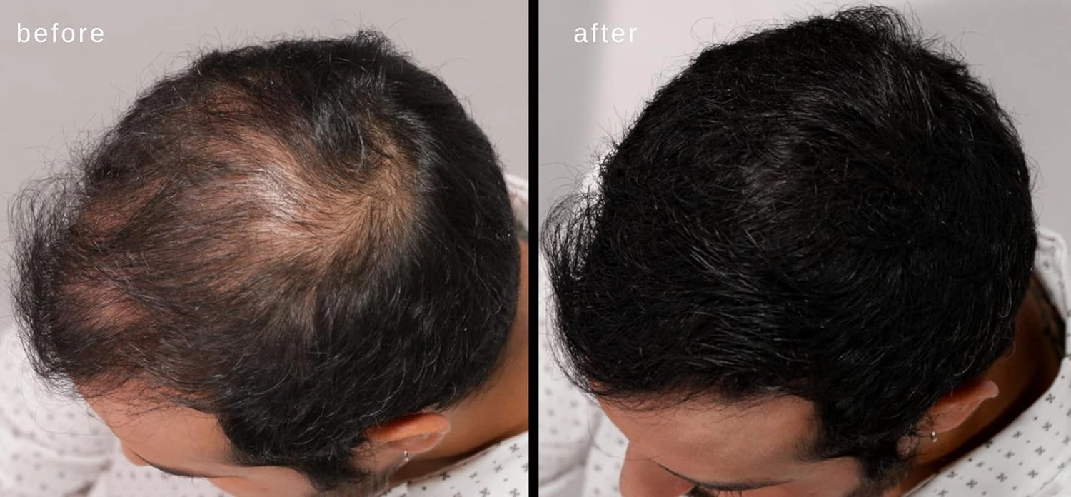 LUXE Hair Thickening Fibers - CONFIDENCE IN A JAR – 2 Months  Supply! – Hypoallergenic, Dermatologist Tested – Multiple Colors Available (Medium Brown)