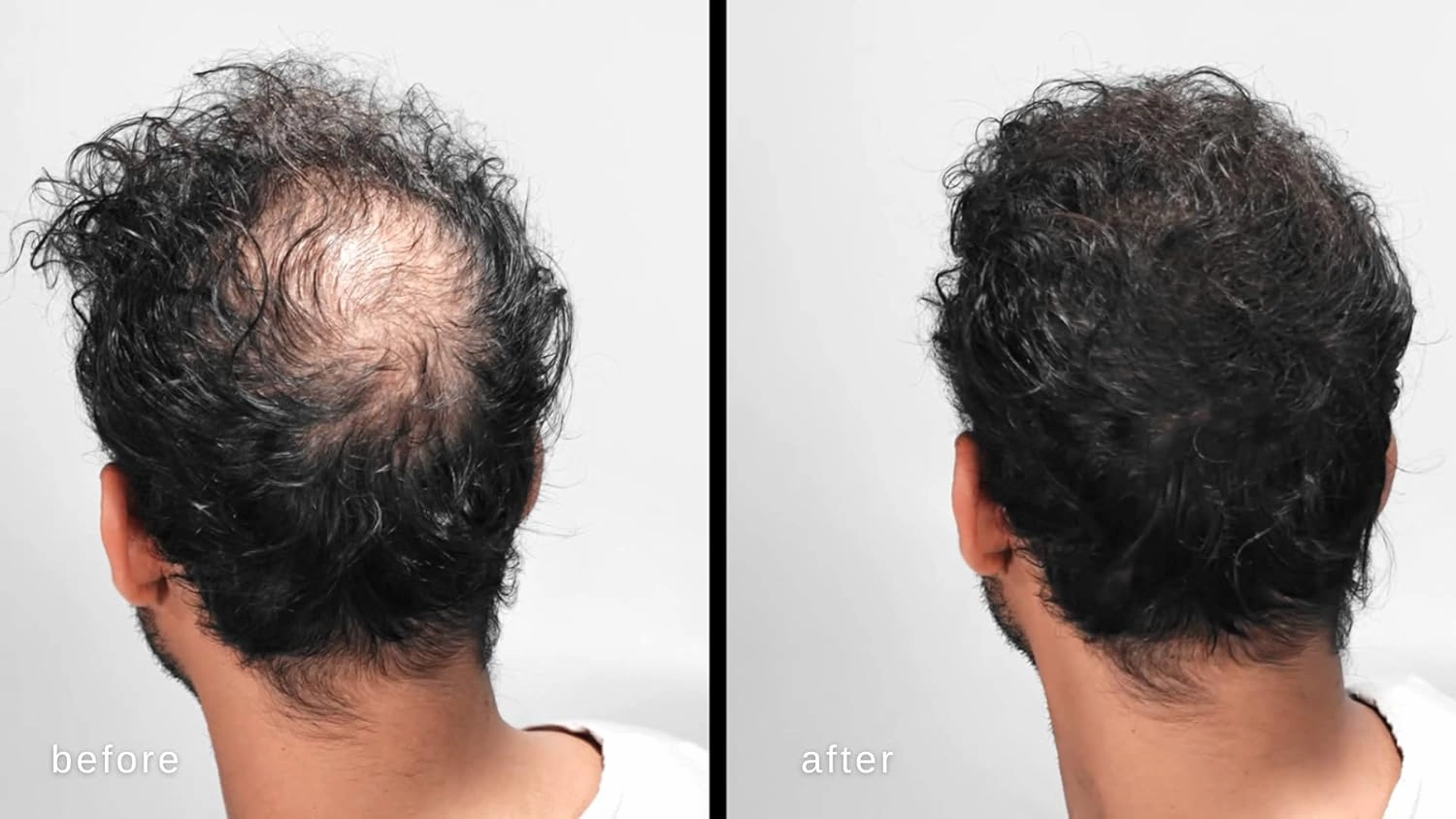 LUXE Hair Thickening Fibers - CONFIDENCE IN A JAR – 2 Months  Supply! – Hypoallergenic, Dermatologist Tested – Multiple Colors Available (Medium Brown)