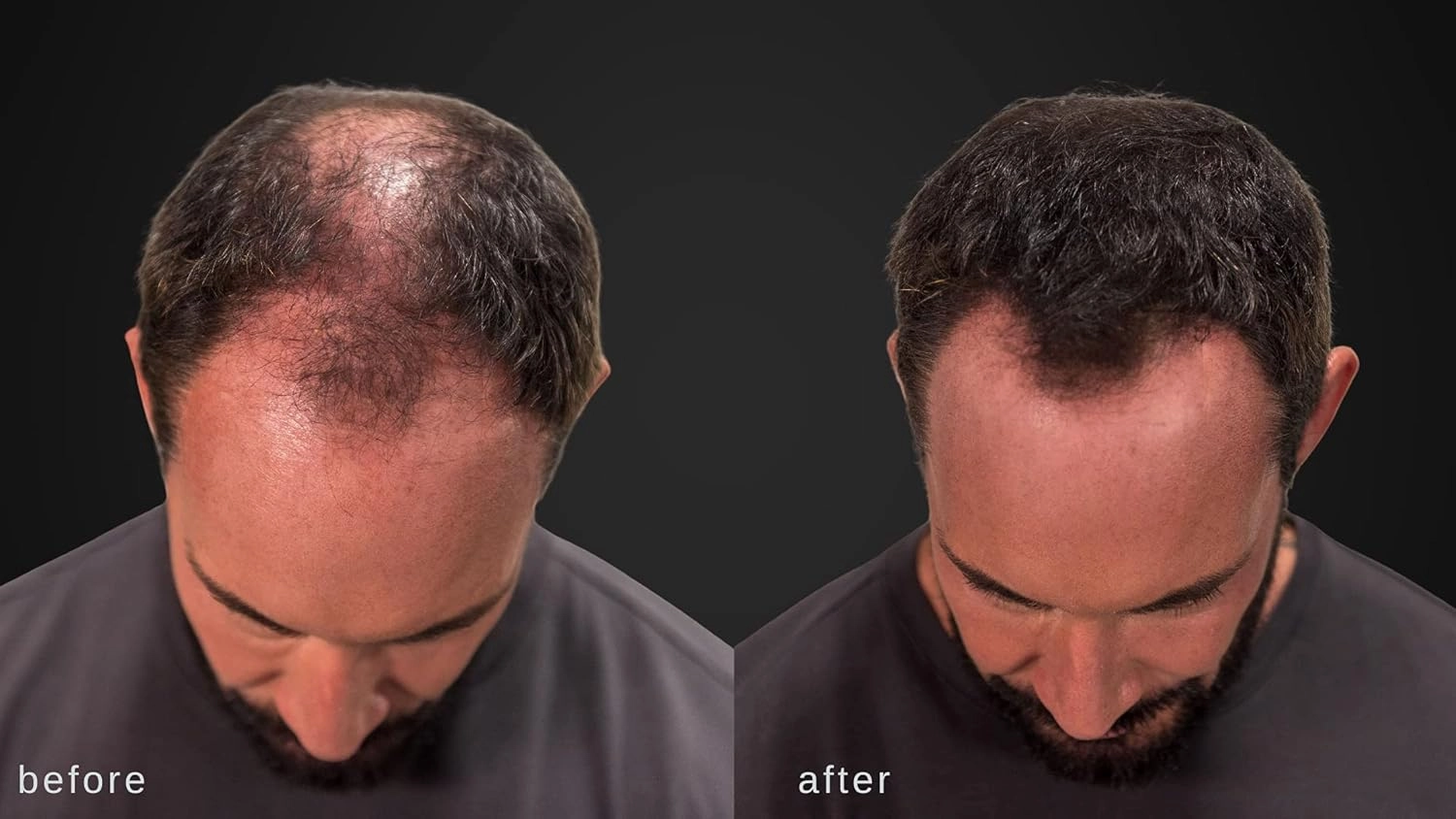 LUXE Hair Thickening Fibers - CONFIDENCE IN A JAR – 2 Months  Supply! – Hypoallergenic, Dermatologist Tested – Multiple Colors Available (Medium Brown)