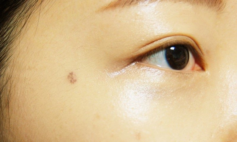 PanDerma under-eye dark circle cream